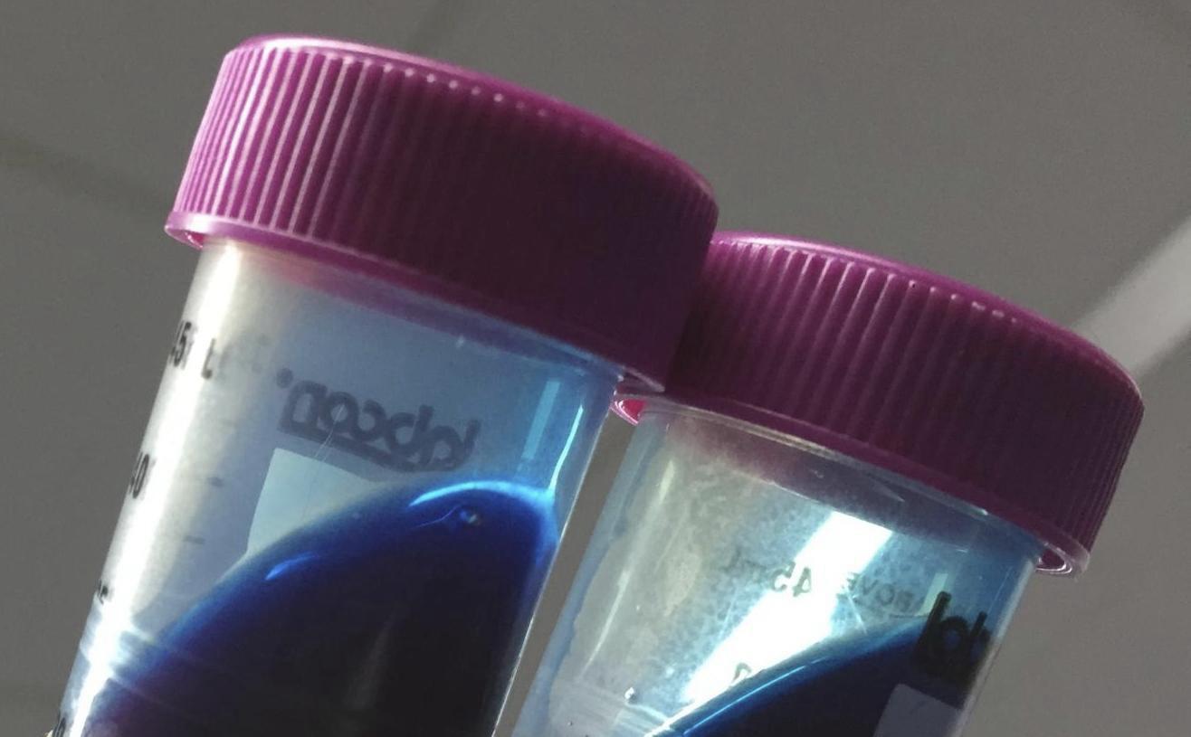 Cyanotone in laboratory — Eppendorf tubes with culture media